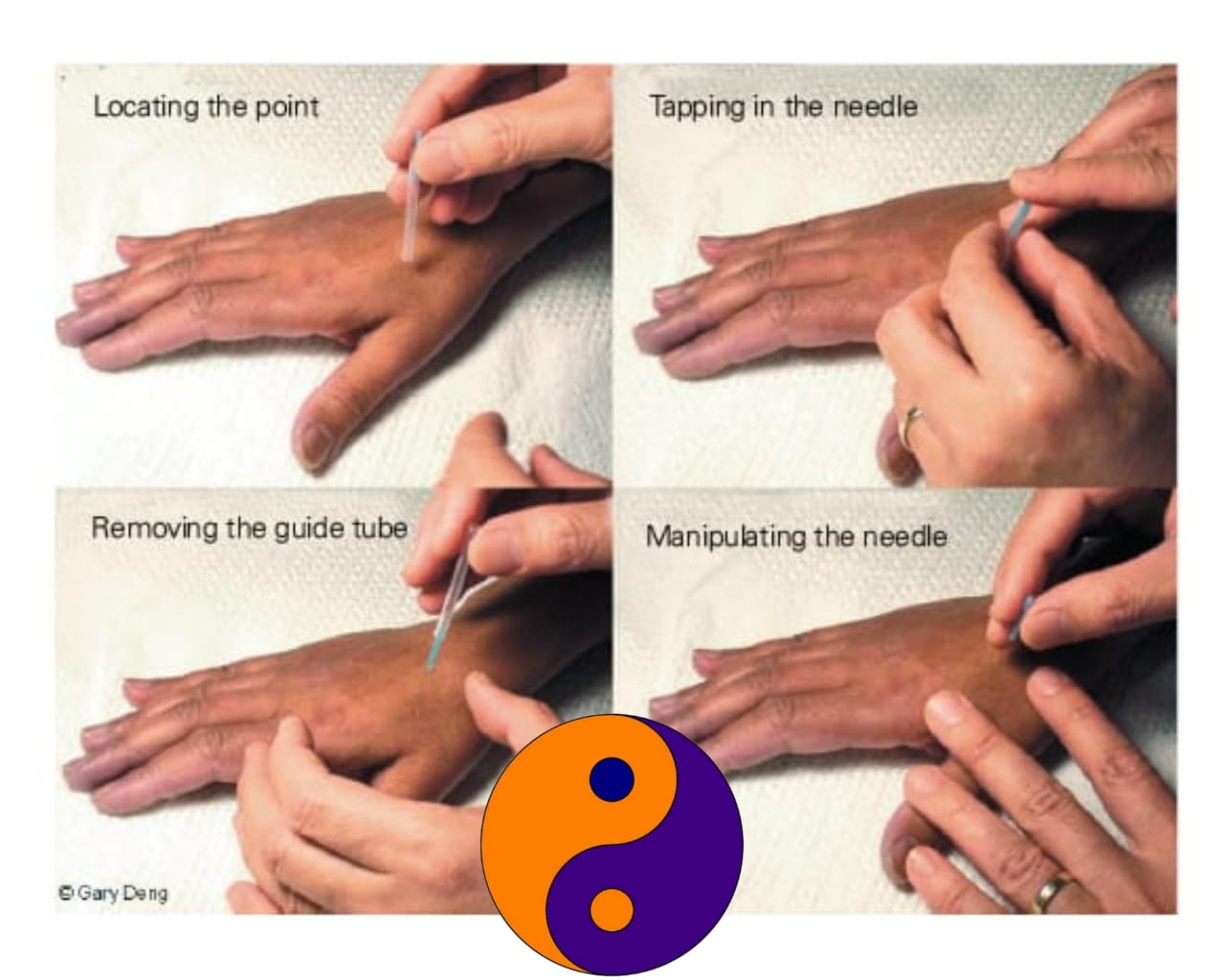 ACUPUNCTURE CLINIC PEYAD TVM