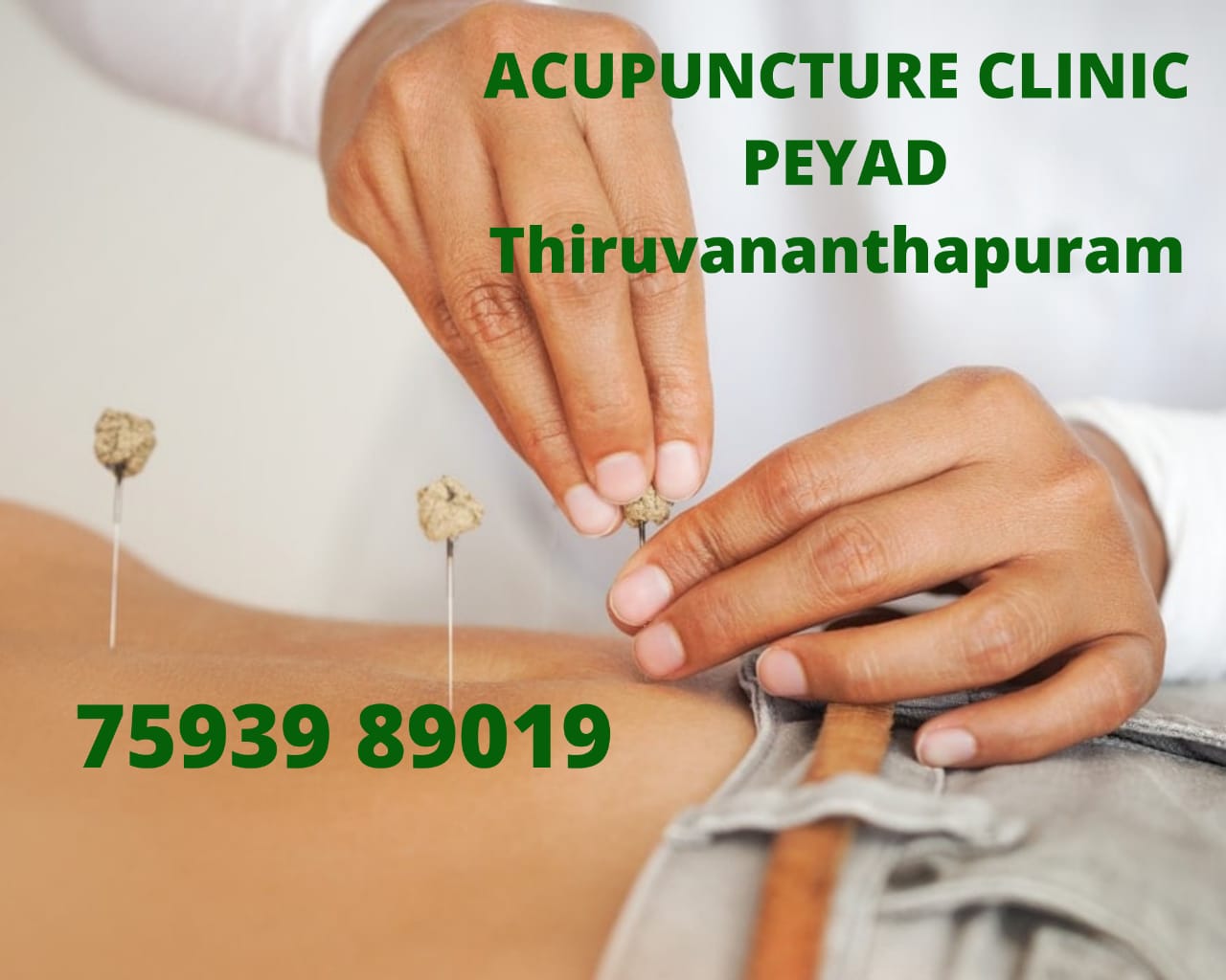 ACUPUNCTURE CLINIC PEYAD TVM