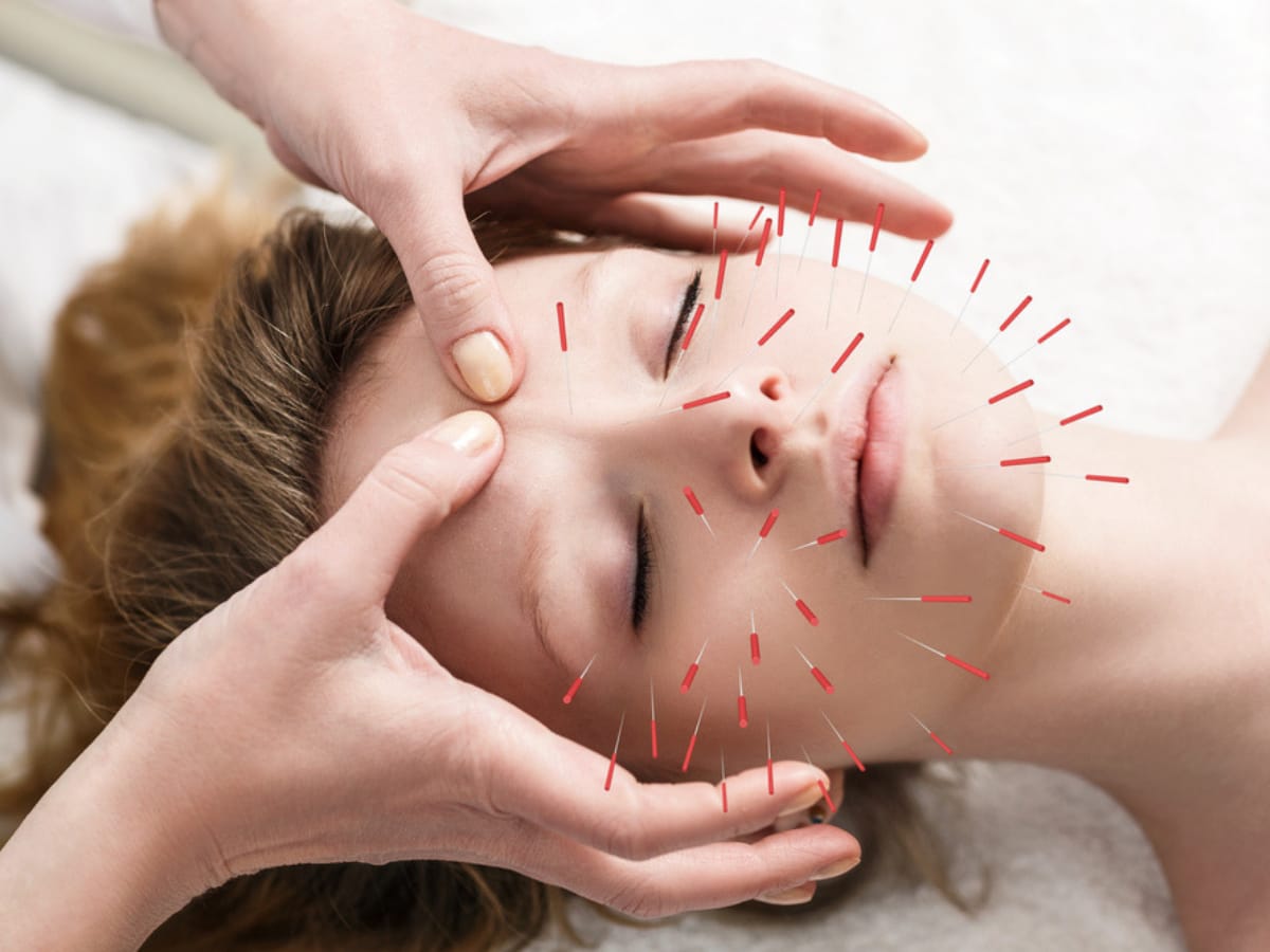 ACUPUNCTURE CLINIC PEYAD TVM