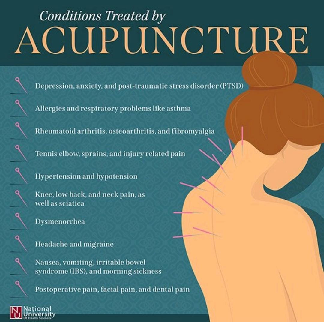 ACUPUNCTURE CLINIC PEYAD TVM